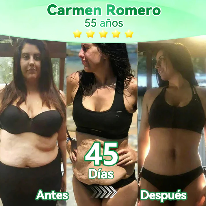 𝑻𝒊𝒆𝒏𝒅𝒂 𝑶𝒇𝒊𝒄𝒊𝒂𝒍 |🍋‍🟩𝐹𝑙𝑜𝑟𝑖𝑠𝑚𝑎® 10 𝑬𝑵 1 𝑴𝒐𝒓𝒊𝒏𝒈𝒂 𝒀 𝑩𝒆𝒓𝒃𝒆𝒓𝒊𝒏𝒂 𝑷𝒂𝒓𝒄𝒉𝒆 𝑨𝒗𝒂𝒏𝒛𝒂𝒅𝒐 𝑫𝒆 𝑴𝒊𝒄𝒓𝒐𝒏𝒆𝒆𝒅𝒍𝒆𝒔 𝑵𝒂𝒏𝒐 (𝑼𝒏𝒂 𝒗𝒆𝒛 𝒂𝒍 𝒅í𝒂, 𝒄𝒂𝒎𝒃𝒊𝒐𝒔 𝒗𝒊𝒔𝒊𝒃𝒍𝒆𝒔 𝒆𝒏 7 𝒅í𝒂𝒔) ✅ 𝑶𝒃𝒆𝒔𝒊𝒅𝒂𝒅, 𝑫𝒊𝒂𝒃𝒆𝒕𝒆𝒔, 𝑨𝒑𝒏𝒆𝒂 𝒅𝒆𝒍 𝑺𝒖𝒆ñ𝒐 𝒚 𝑷𝒓𝒐𝒃𝒍𝒆𝒎𝒂𝒔 𝑨𝒓𝒕𝒊𝒄𝒖𝒍𝒂𝒓𝒆𝒔